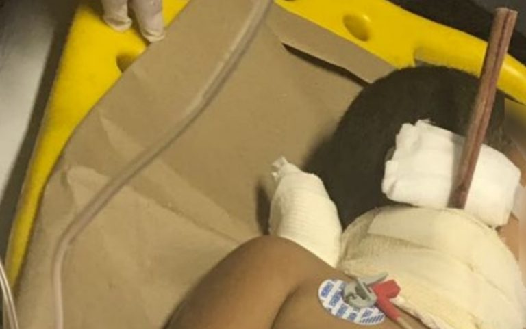 Criança de três anos ferida com pedaço de madeira no pescoço segue internada em Goiânia