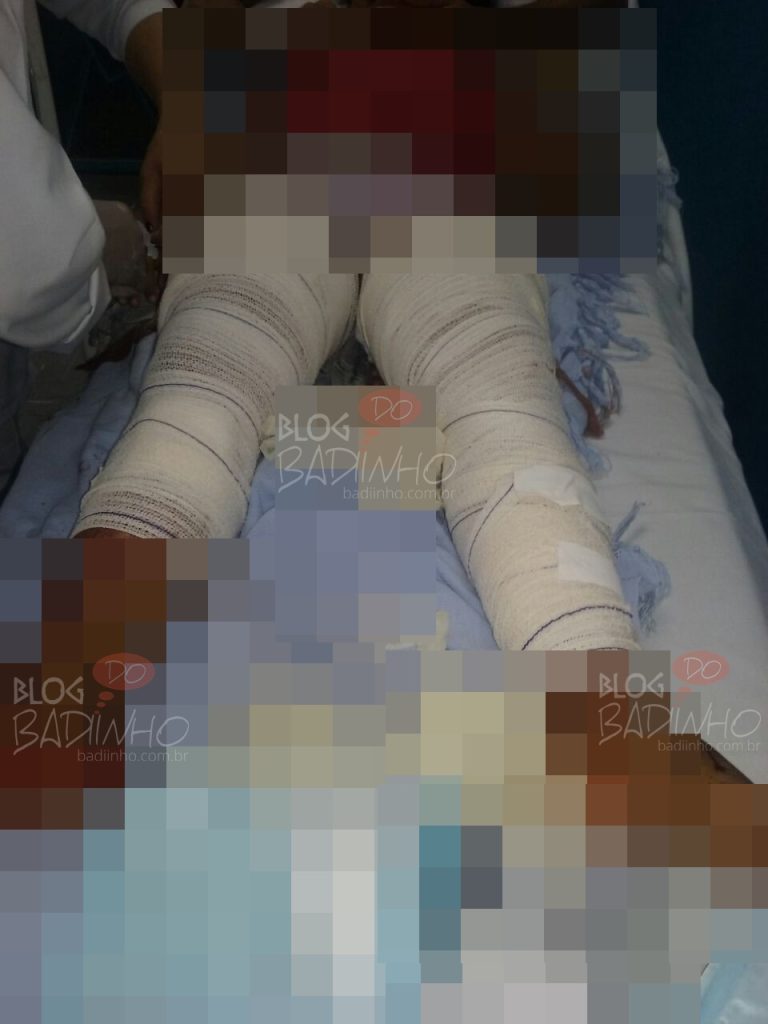 Três Ranchos: irmãs são atacadas por três cães de raça não definida, entre elas uma criança de sete anos