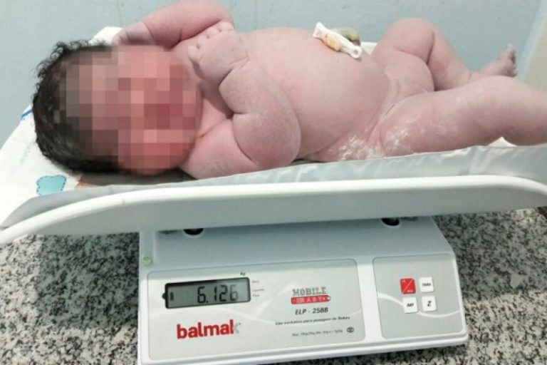 Recém-nascida de 6 quilos chama a atenção de médicos no Norte de Minas