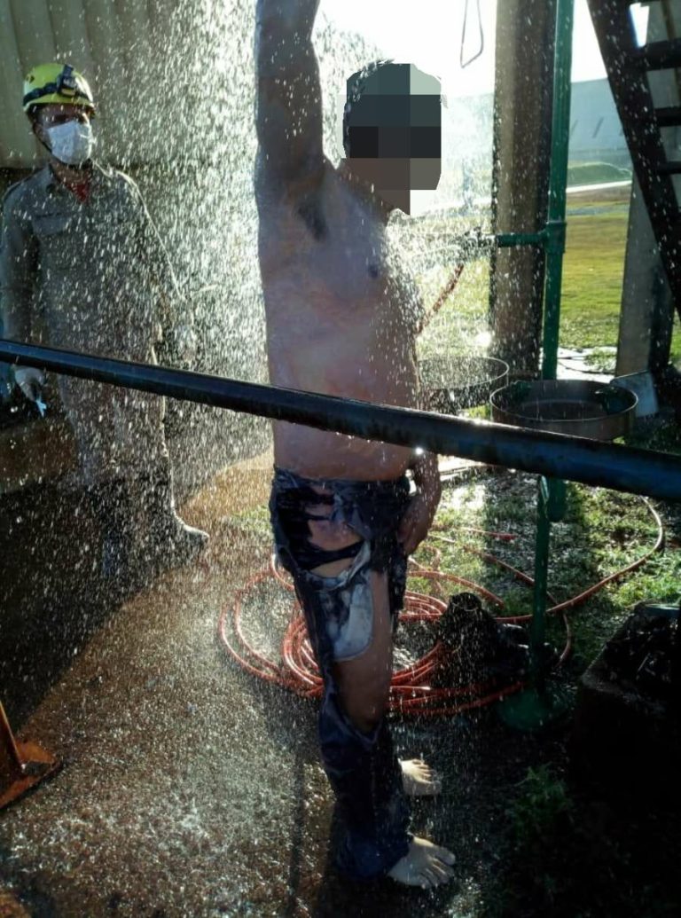Em Ipameri homem de 37 anos sofre queimaduras de 1º e 2º grau com ácido sulfúrico