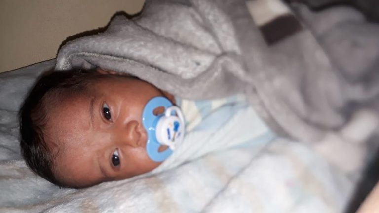 AJUDEM O JOÃO EDUARDO, BEBÊ DE 1 MÊS QUE SOFRE COM PARALISIA RENAL E SÍNDROME DE POTTER TIPO 2; ACESSE O BLOG DO BADIINHO E CONHEÇA O CASO