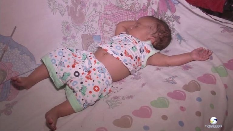 COM INSUFICIÊNCIA RENAL E PORTADOR DE SÍNDROME DE POTTER 2, PAIS DE BEBÊ DE 1 MÊS DE VIDA PEDEM AJUDAM PARA TRATAMENTO DE ALTO CUSTO; CONHEÇA O CASO NO BLOG DO BADIINHO E VEJA COMO AJUDAR