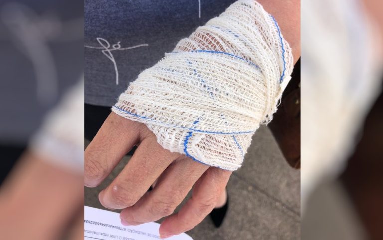 TÉCNICA EM ENFERMAGEM DENUNCIA QUE PACIENTE A AGREDIU JUNTO COM PARENTES APÓS ESPERA POR RESULTADO DE EXAME: ‘TERRÍVEL’