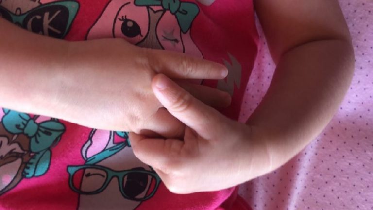 EM CATALÃO, BEBÊ DE OITO MESES FOI DIAGNOSTICA COM CORONAVÍRUS (SARS COV2); CRIANÇA ESTÁ FAZENDO TRATAMENTO EM CASA