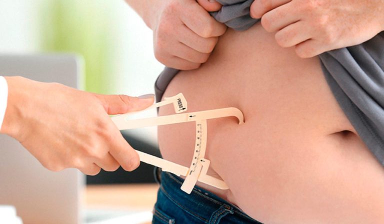 OBESIDADE E O DIREITO À CIRURGIA BARIÁTRICA