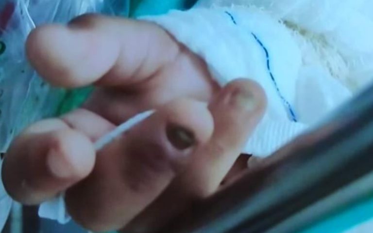 GOIÂNIA: MÃE É IMPEDIDA DE SE APROXIMAR DA FILHA DE 2 ANOS ENCONTRADA SEM UNHAS E COM LESÕES NO INTESTINO