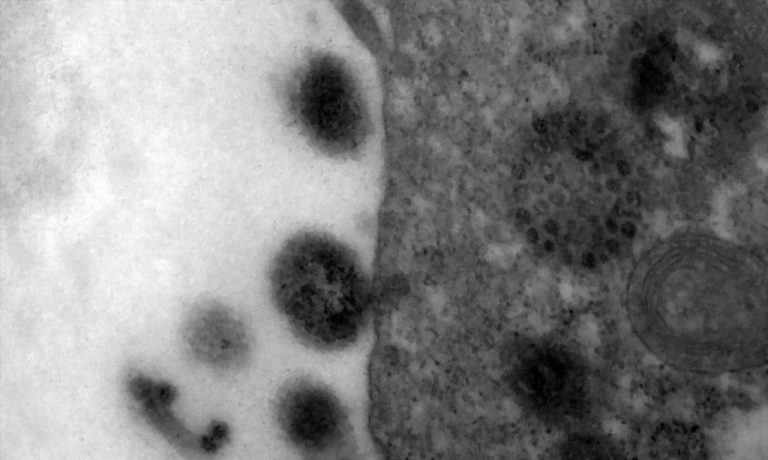 COVID-19: ANTICORPOS PODEM DURAR ATÉ 12 MESES APÓS INFECÇÃO
