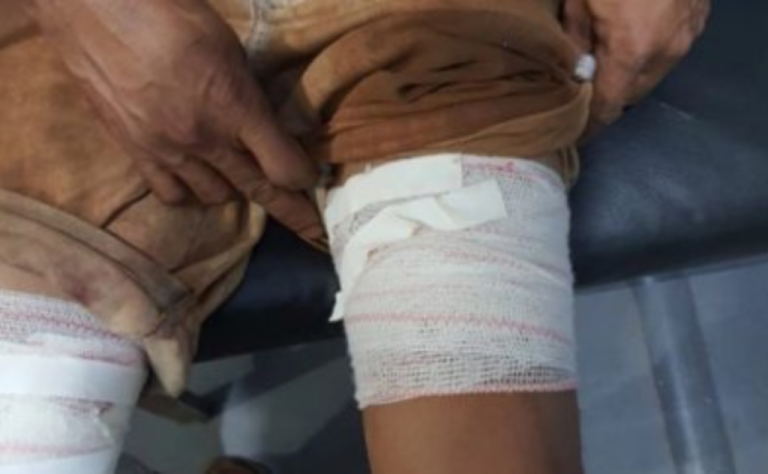 Homem tenta matar porco e acaba atirando três vezes em si mesmo em chácara em MT, diz polícia
