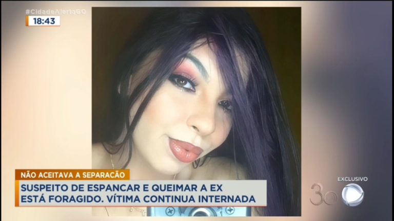 ‘Ele ameaçava que se ela não voltasse com ele, ele ia matar minha mãe’, diz irmã da jovem que foi queimada pelo ex