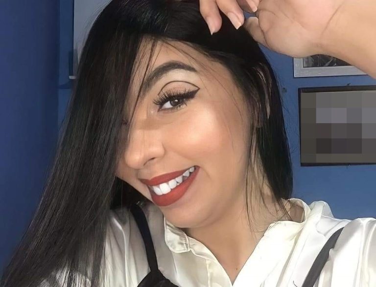 Após um mês internada, jovem que foi queimada com álcool pelo ex-marido deixa a UTI
