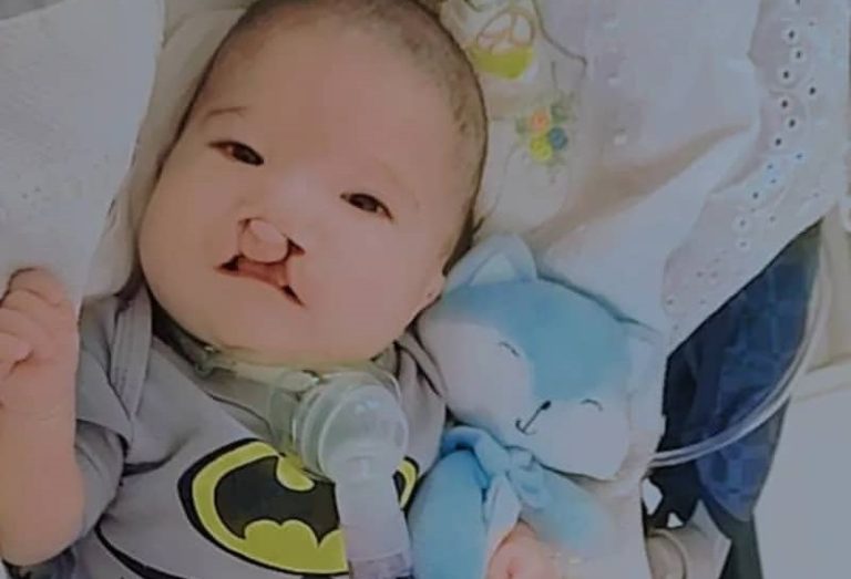 SOLIDARIEDADE: mãe pede ajuda para o filho recém-nascido com más-formações, em Catalão; “ele tá sofrendo muito”