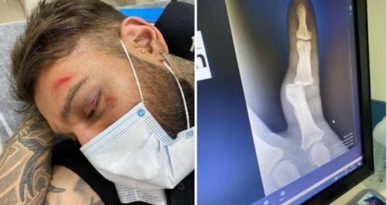Lucas Lucco vai a hospital após acidente doméstico: ‘Bebi demais’