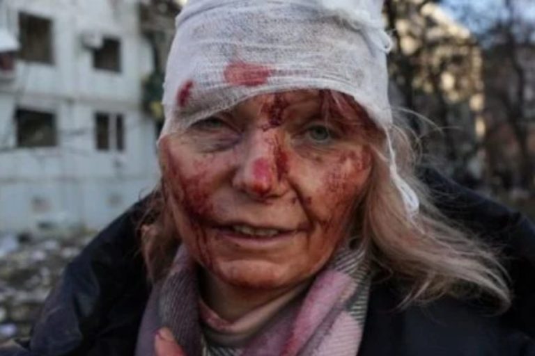 UCRÂNIA TEM 57 MORTOS E 169 FERIDOS APÓS BOMBARDEIOS DA RÚSSIA