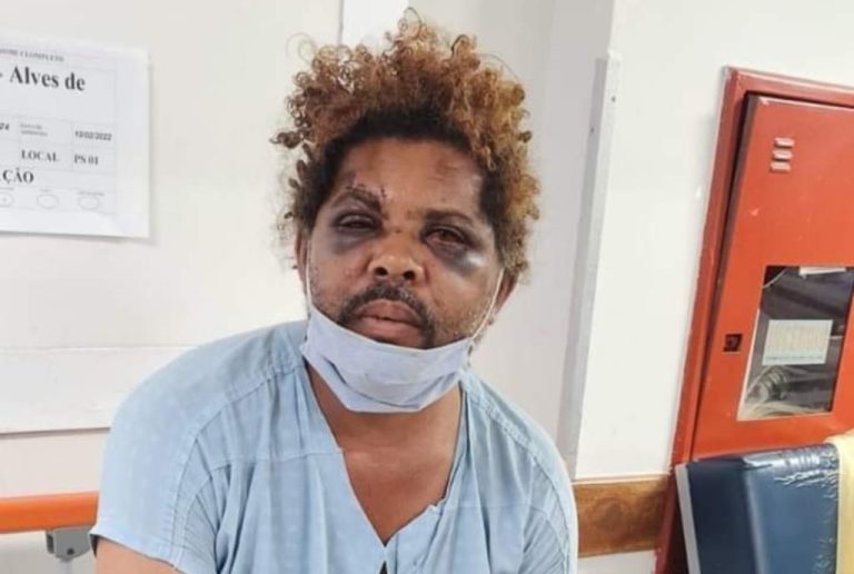 MORADOR DE RUA AGREDIDO POR PERSONAL É RETIRADO DA CIDADE PARA SUA SEGURANÇA