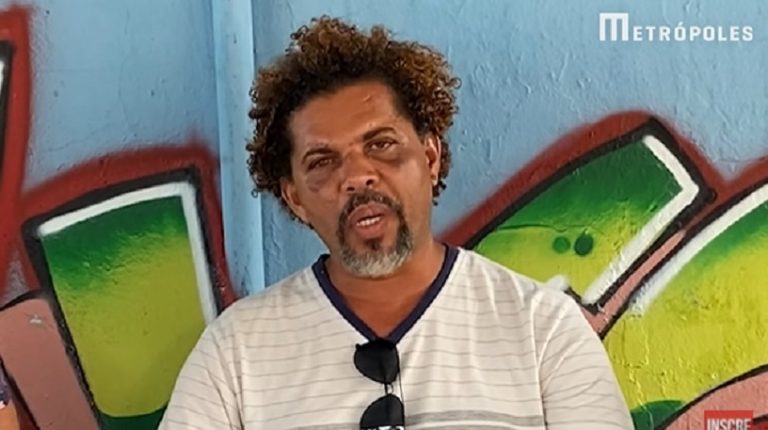 MORADOR DE RUA AGREDIDO POR PERSONAL NO DF DEU ENTREVISTA AO SITE METRÓPOLES : “NÃO ME ARREPENDO”