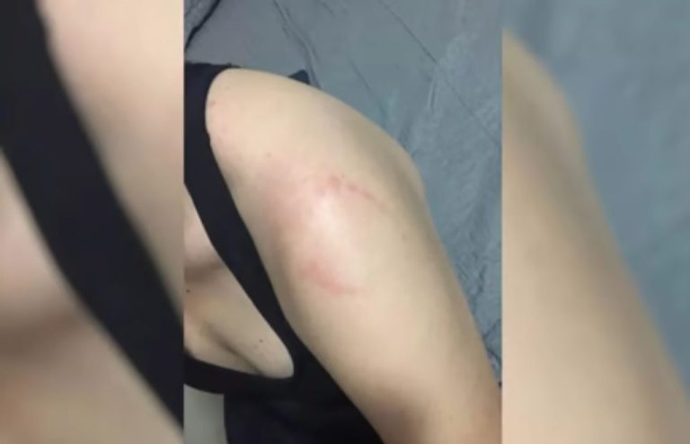 HOMEM É INVESTIGADO POR MORDER BRAÇO DE MULHER EM ACADEMIA DE RIO VERDE