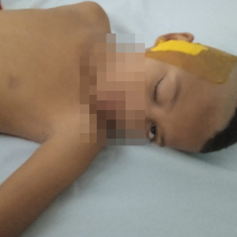 OMISSÃO EM OUVIDOR: ATRASO EM REMOVER CISTO NO CÉREBRO DE CRIANÇA DE 6 ANOS  PODERÁ OCASIONAR SEQUELAS PERMANENTES