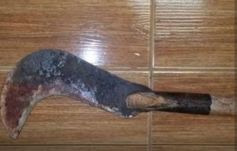 USANDO UMA FOICE, HOMEM DECEPA BRAÇO INTEIRO DE MULHER EM ANÁPOLIS
