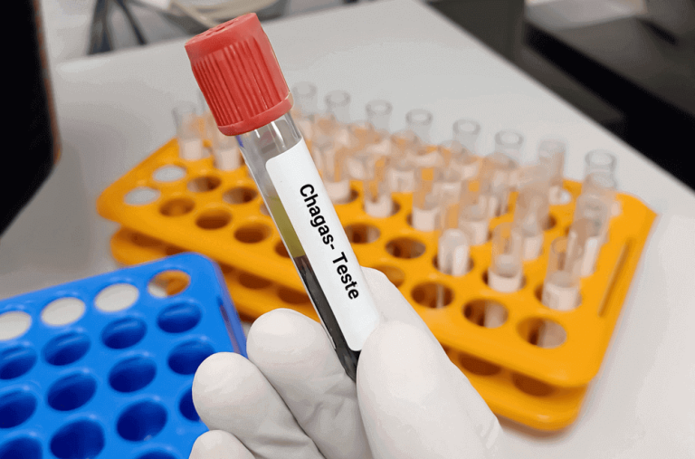 SECRETARIA DE SAÚDE DE CATALÃO VAI REALIZAR TESTAGEM SOROLÓGICA PARA DOENÇAS DE CHAGAS NESTA QUINTA-FEIRA (20)