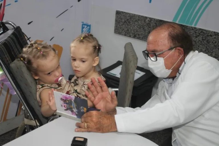 VALENTINA, SIAMESA SEPARADA, APRESENTA MELHORA APÓS QUADRO SE AGRAVAR, DIZ BOLETIM DE HOSPITAL