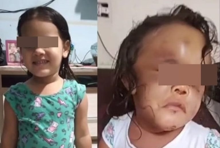 VIOLÊNCIA CONTRA CRIANÇAS: A IMPORTÂNCIA DA ATUAÇÃO DOS ÓRGÃOS DE PROTEÇÃO E JUSTIÇA