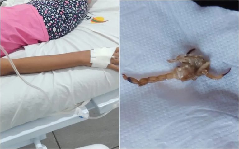 MENINA DE 8 ANOS É ATACADA POR ESCORPIÃO DENTRO DE CASA EM CATALÃO
