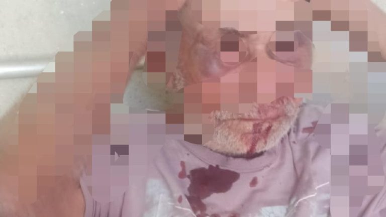 IDOSO DE 71 ANOS DE IDADE É ESPANCADO EM CATALÃO