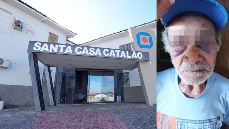 IDOSO AGREDIDO EM CATALÃO PRECISA PASSAR POR CIRURGIA EMERGENCIAL APÓS SUPOSTA NEGLIGÊNCIA MÉDICA NA SANTA CASA