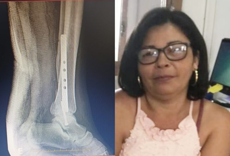 VAMOS AJUDAR: Amigos organizam rifa para ajudar colega de trabalho afastada por acidente