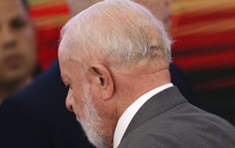 Lula passa por cirurgia de emergência em São Paulo