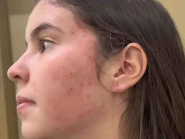 Ex-vereadora agride filha de prefeito em Pires do Rio