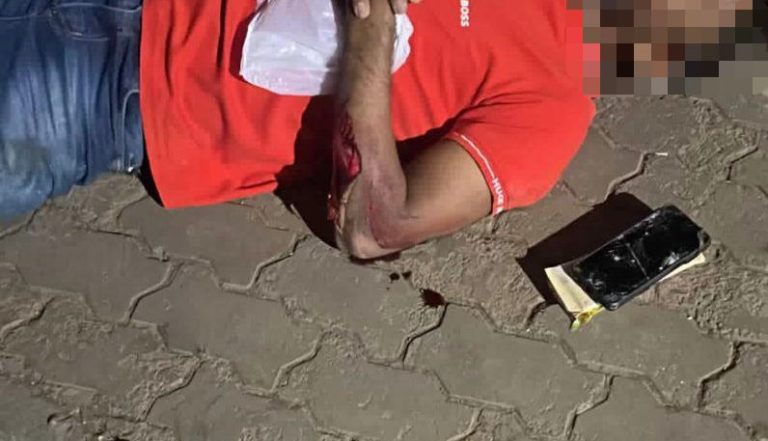 Motociclista fica gravemente ferido após atropelamento em Catalão; motorista foge sem prestar socorro