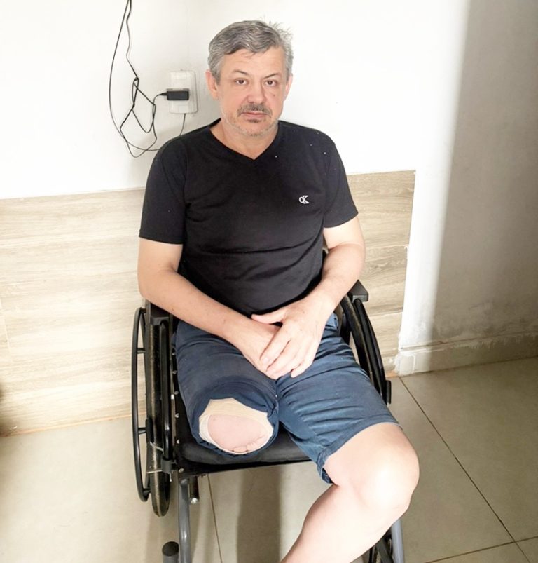 Catalano precisa de ajuda para comprar prótese após amputação da perna