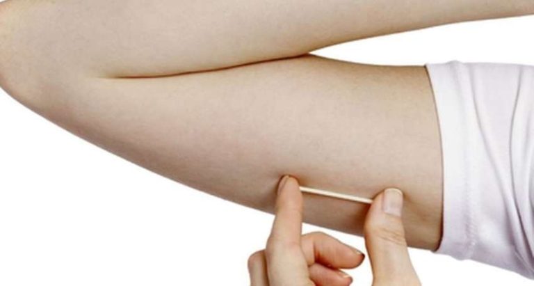 Prefeitura de Catalão inicia oferta de novo implante contraceptivo na rede municipal de saúde