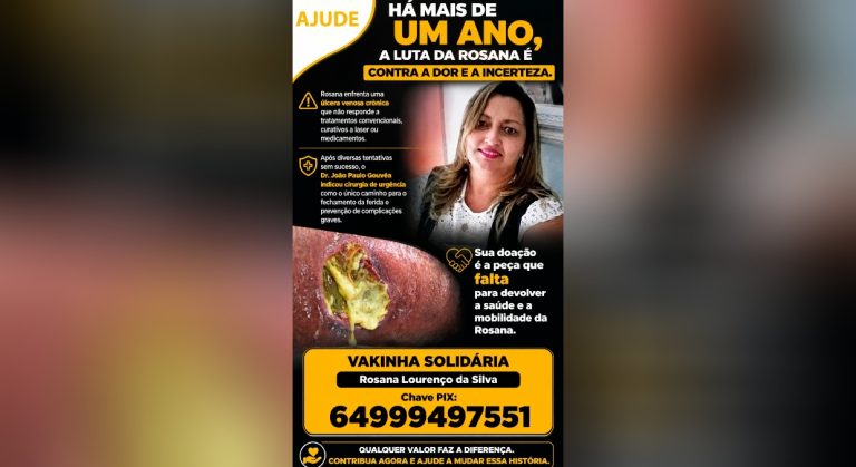 Badiinho Solidário: Rosana enfrenta úlcera venosa crônica e faz campanha solidária para cirurgia urgente